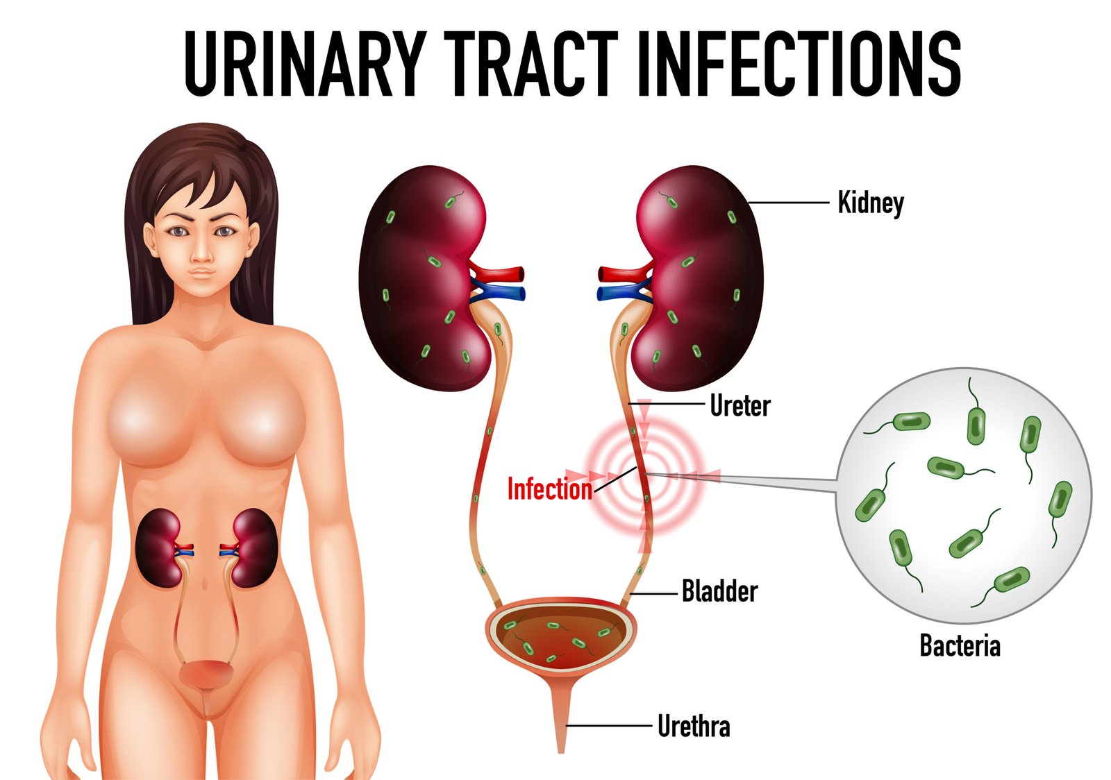 can uti cause headache